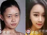 《中国好声音》吴玉青花百万整容变脸Baby